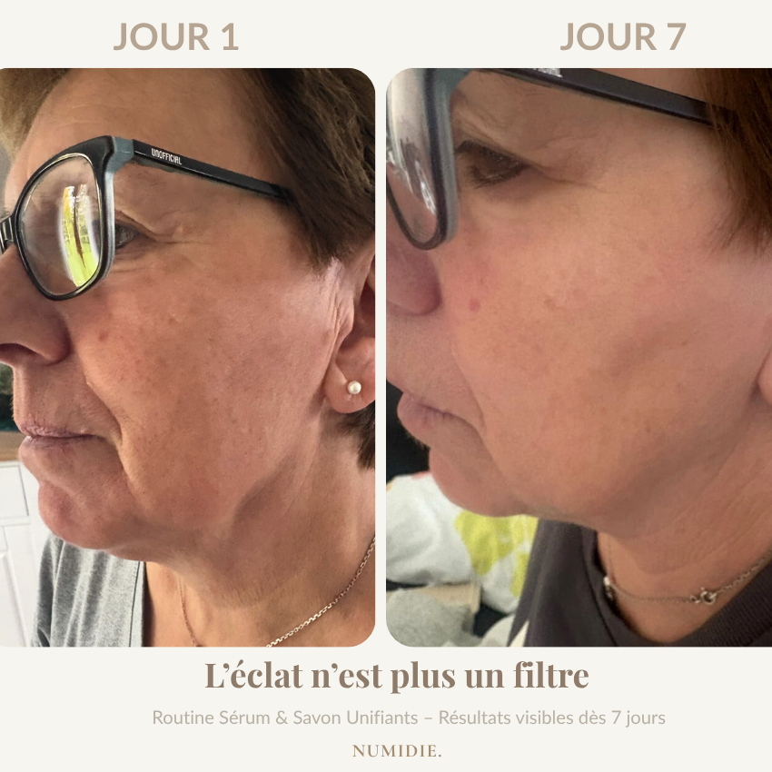 Routine complète – 2 sérums + savon offert