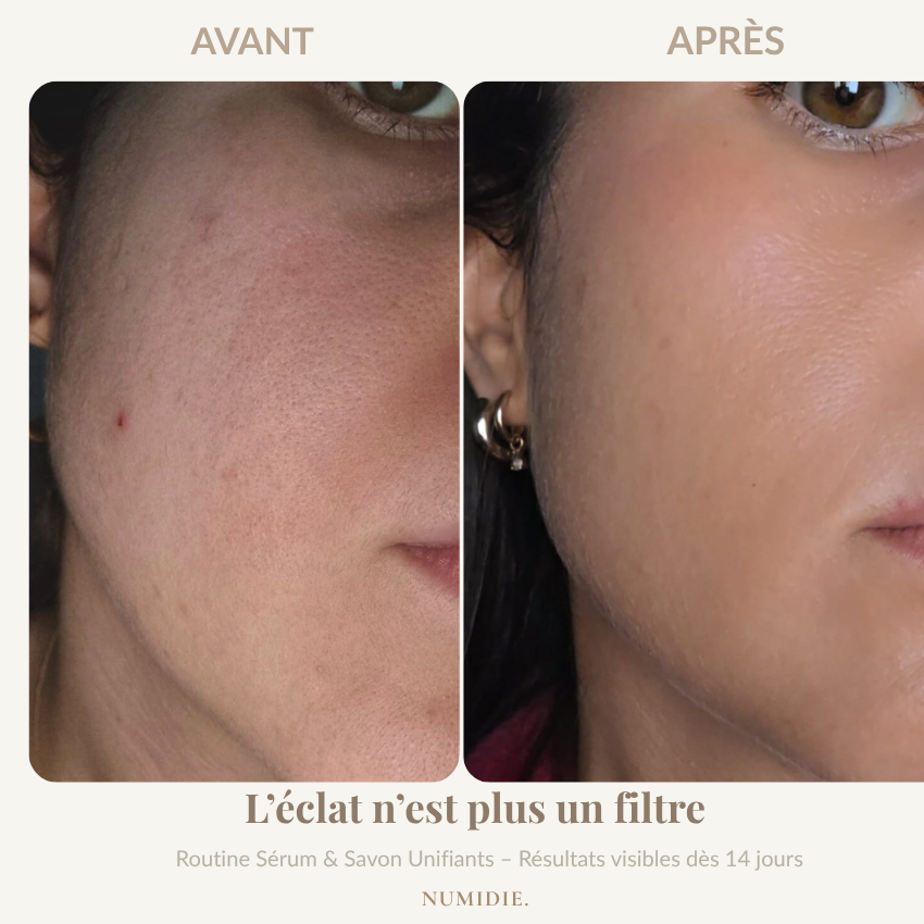 Routine Éclat Naturel – Sérum & Savon au Macérat de Lys | Numidie
