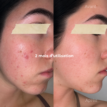 Duo Anti-Imperfections