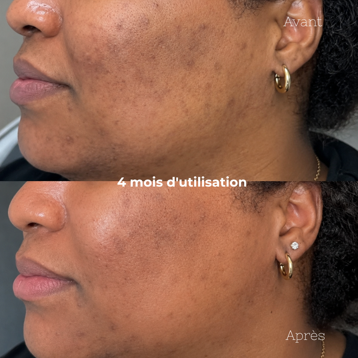 Duo Anti-Imperfections