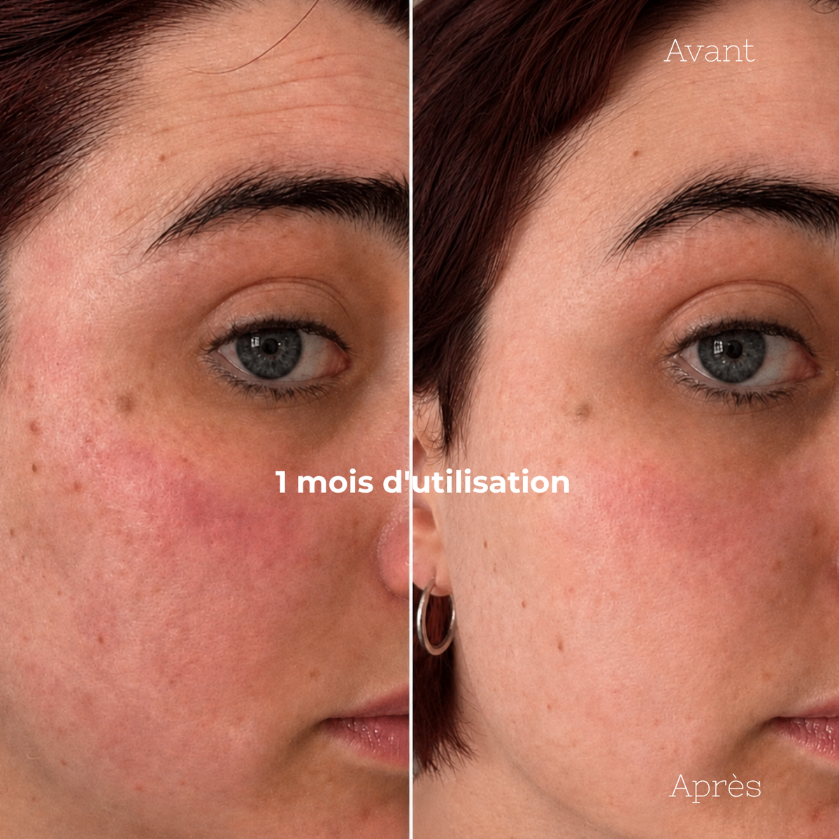 Sérum Anti-Imperfections