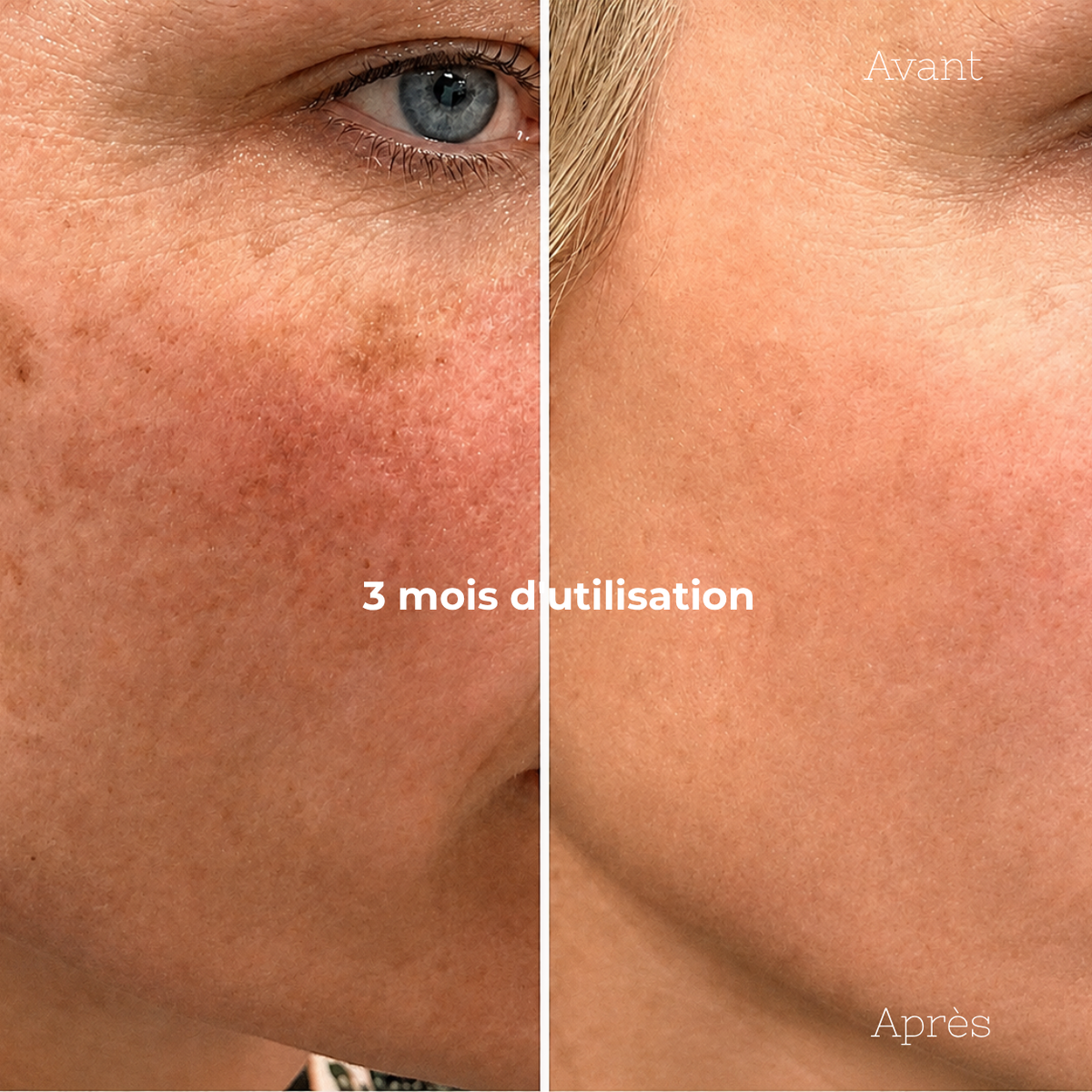 Duo Anti-Imperfections