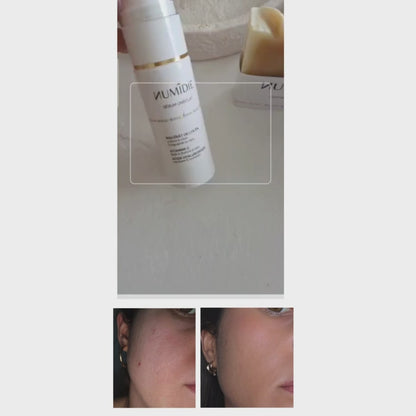 Routine complète – 2 sérums + savon offert