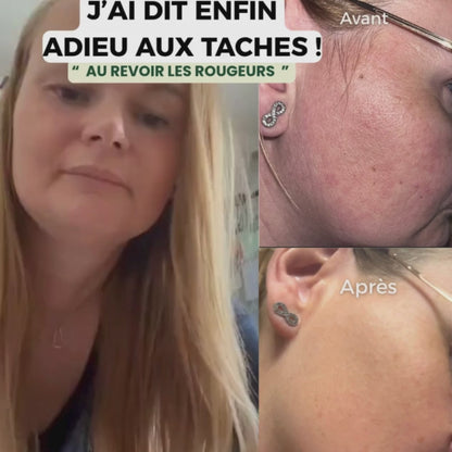 Routine Éclat Naturel – Sérum & Savon au Macérat de Lys | Numidie